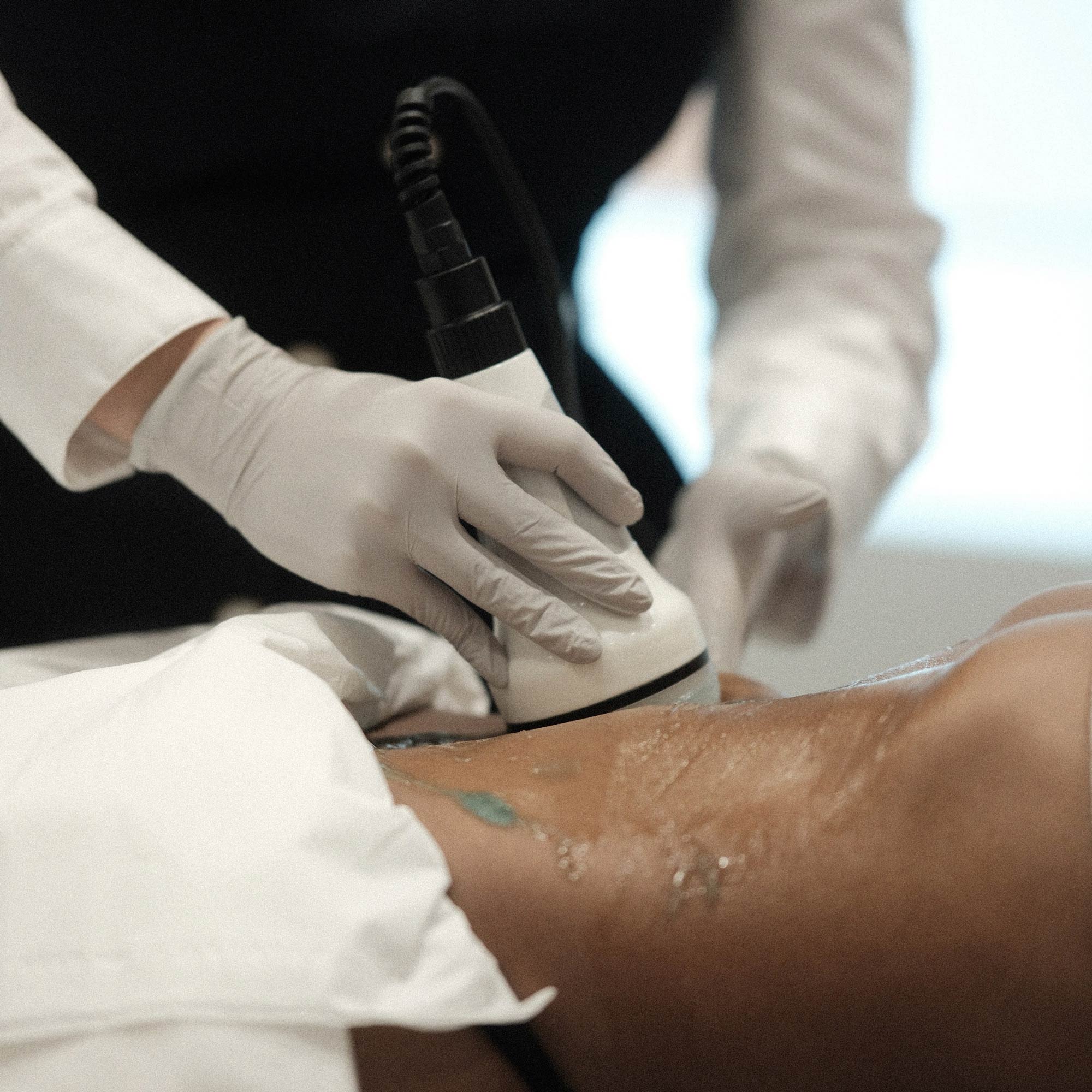 Cavitação e radiofrequência